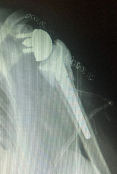 Caso clinico KIWI3D 11
