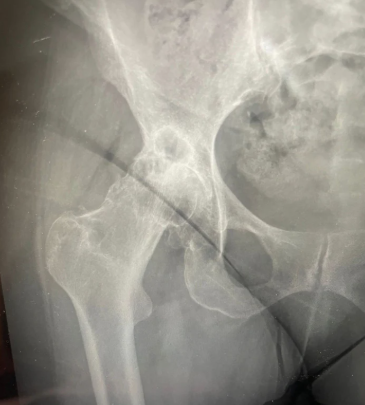 Caso clinico KIWI3D 6
