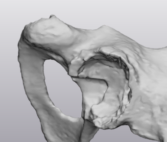 Caso clinico KIWI3D 7