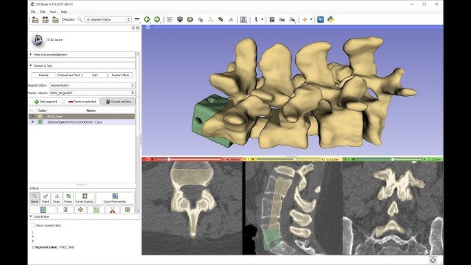 Ricostruzione 3D